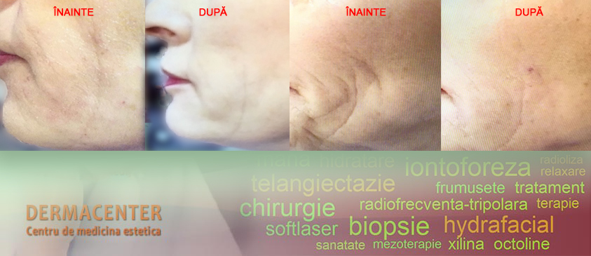 Dr. Cristina Stanescu - Videodermatoscopie Mole Max la Dermacenter